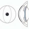 Расчёт интраокулярных факичных линз (встраиваемых в глаз) – продолжаем про глаз и его биомеханику