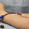 Переливание «молодой» крови все же дает эффект