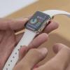 Apple работает над тем, чтобы добавить своим будущим часам возможность получать электрокардиограмму