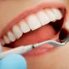 В Канаде создали сверхпрочные пломбы для зубов