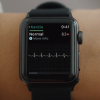 Я врач неотложной помощи, и я хочу поговорить о новой электрокардиограмме Apple Watch