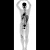 Первый в мире сканер для всего тела: посмотрите на уникальные фотографии