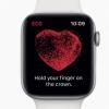 Нью-Йоркский кардиолог обвинил Apple в нарушении патента