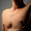 Названы симптомы рака груди у мужчин
