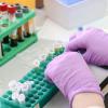 Новый способ обнаружения рака: ИИ ставит диагноз по ДНК микроорганизмов из крови