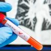 «Яндекс» начал доставку тестов на коронавирус