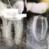 Где и как обычно ошибаются стоматологи (частично применимо и к другим врачам)