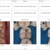 Наш пациент имеет доступ к карточке, фотографиям вмешательств, γ-снимкам зубов и всем протоколам лечения