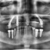 «А вот все эти зубы — к чёртовой матери» — случай пациента