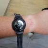 Опасные технологии: пользователь получил ожог от умных часов Samsung Galaxy Watch