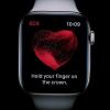 Джо Байден решит судьбу Apple Watch в США? Компания обвиняется в нарушении патентов